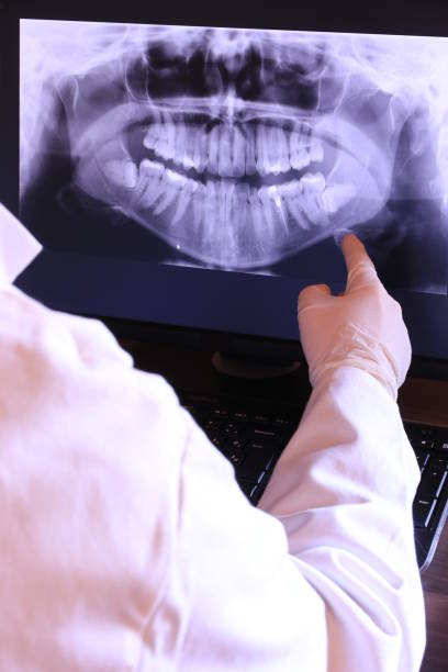 Best Emergency Tooth Extraction in Britt, IA
