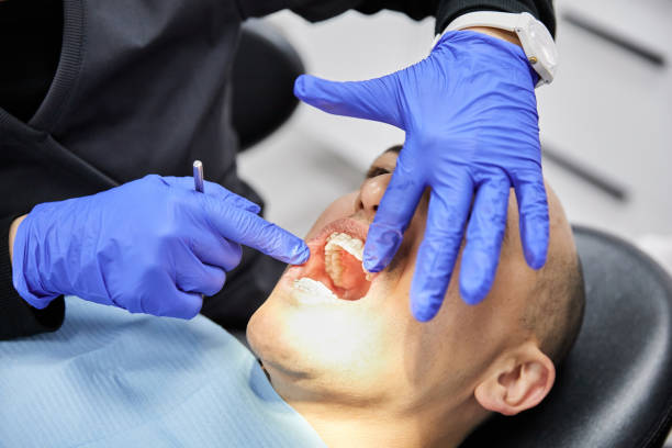 Best Emergency Treatment for Dental Infections or Abscesses in Britt, IA